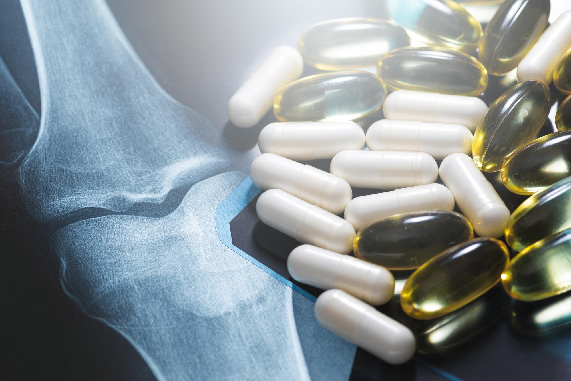 Glucosamine — Loại Nào Tốt Nhất? Review Top 5
